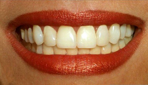 teeth-meaning