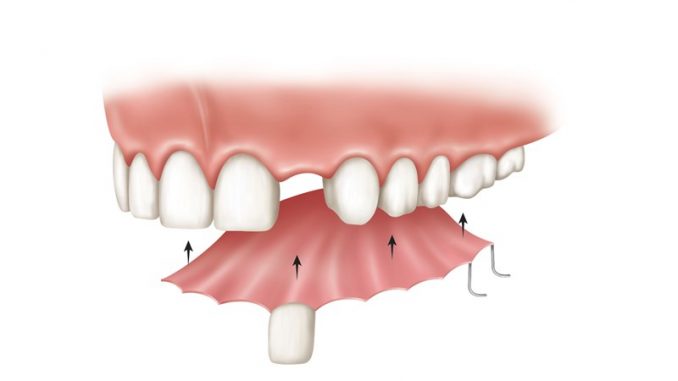 tooth-dentures
